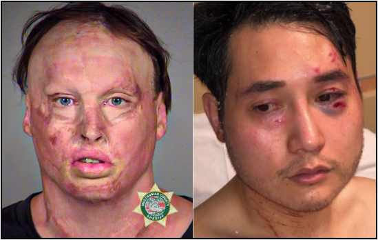 antifa-Andy-NGO