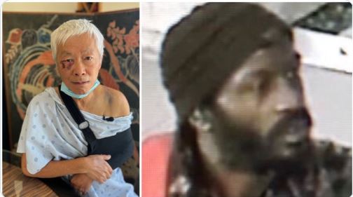 San-Francisco-Hate-Crime